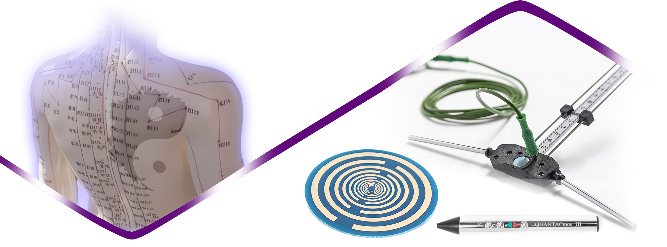 Acupuncture sans aiguilles à Béziers